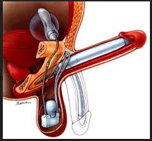  Urology Department