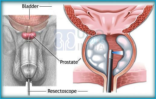  Urology Department