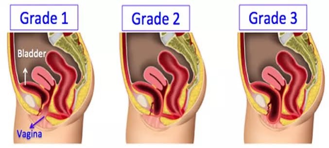  Urology Department