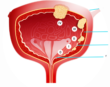  Urology Surgery