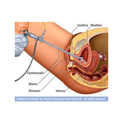  Urology Surgery