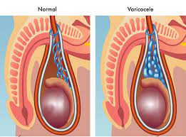  Urology Surgery