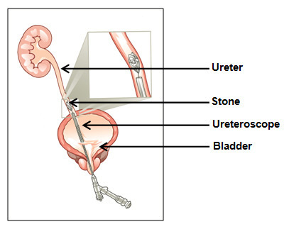  Urology Surgery