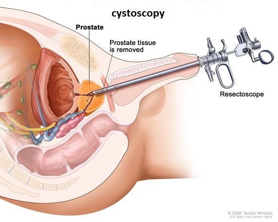  Urology Surgery