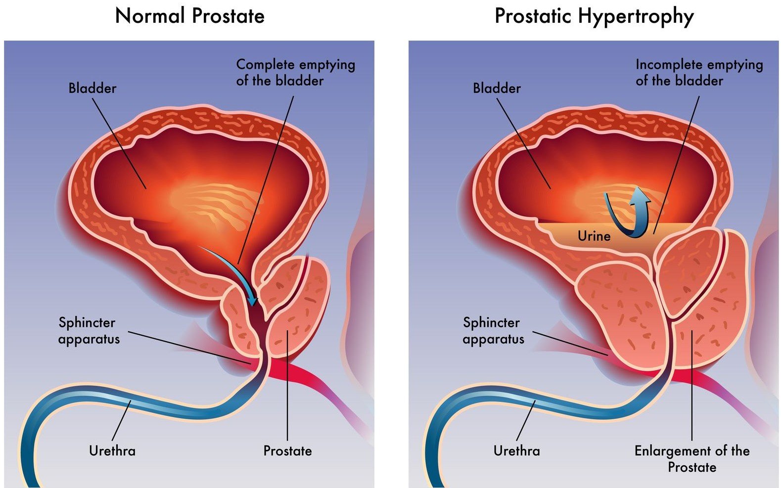  Urology Surgery