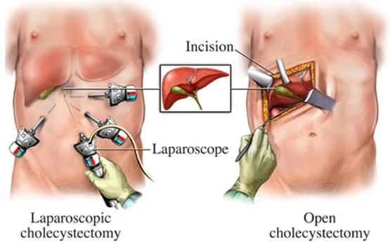  Urology Surgery